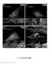 Fig. 17 - HUMAN INDUCED NEURONAL CELLS