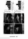 Fig. 53 - HUMAN INDUCED NEURONAL CELLS