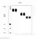 Fig. 04 - Stable compositions of high-concentration allotype-selected antibodies for small-volume administration