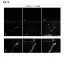 Fig. 11 - Methods for establishing and improving the survival of a population of pancreatic progenitor or stem cells