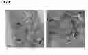 Fig. 19 - Methods for establishing and improving the survival of a population of pancreatic progenitor or stem cells