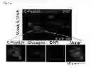 Fig. 35 - Methods for establishing and improving the survival of a population of pancreatic progenitor or stem cells