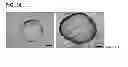 Fig. 38 - Methods for establishing and improving the survival of a population of pancreatic progenitor or stem cells