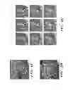 Fig. 04 - Combined chemical modification of sphingosine-1-phosphate (S1P) and CXCR4 signalling pathways for hematopoietic stem cell (HSC) mobilization and engraftment