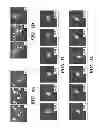 Fig. 12 - Combined chemical modification of sphingosine-1-phosphate (S1P) and CXCR4 signalling pathways for hematopoietic stem cell (HSC) mobilization and engraftment