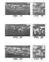 Fig. 19 - Combined chemical modification of sphingosine-1-phosphate (S1P) and CXCR4 signalling pathways for hematopoietic stem cell (HSC) mobilization and engraftment