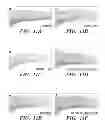 Fig. 21 - Combined chemical modification of sphingosine-1-phosphate (S1P) and CXCR4 signalling pathways for hematopoietic stem cell (HSC) mobilization and engraftment