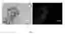 Fig. 06 - GHRH agonists for islet cell transplantation and function and the treatment of diabetes