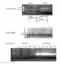 Fig. 07 - Method of cell transplantation into a human recipient