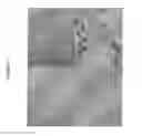 Fig. 13 - Method of cell transplantation into a human recipient