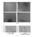 Fig. 14 - Pertussis antibodies and uses thereof