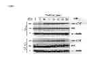 Fig. 02 - Methods used in sensitizing invasive glioblastoma to therapeutic treatment
