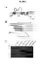 Fig. 06 - Membrane transporter NaPi2b (SCL34A2) epitope antibodies