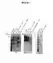 Fig. 07 - Membrane transporter NaPi2b (SCL34A2) epitope antibodies