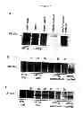 Fig. 10 - Membrane transporter NaPi2b (SCL34A2) epitope antibodies
