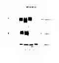Fig. 25 - Membrane transporter NaPi2b (SCL34A2) epitope antibodies