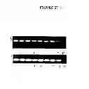 Fig. 30 - Membrane transporter NaPi2b (SCL34A2) epitope antibodies