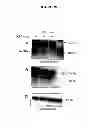Fig. 31 - Membrane transporter NaPi2b (SCL34A2) epitope antibodies