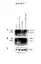 Fig. 32 - Membrane transporter NaPi2b (SCL34A2) epitope antibodies