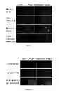 Fig. 04 - METHOD AND MEDICAMENT FOR INHIBITING LYMPHANGIOGENESIS
