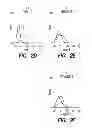 Fig. 04 - BCMA-BASED STRATIFICATION AND THERAPY FOR MULTIPLE MYELOMA PATIENTS