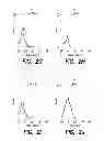 Fig. 05 - BCMA-BASED STRATIFICATION AND THERAPY FOR MULTIPLE MYELOMA PATIENTS