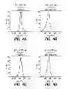Fig. 07 - BCMA-BASED STRATIFICATION AND THERAPY FOR MULTIPLE MYELOMA PATIENTS