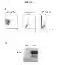 Fig. 02 - COMPOSITIONS AND METHODS FOR CANCER TREATMENT