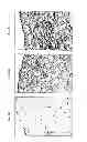 Fig. 09 - METHODS FOR PREPARATION OF NEO-CARTILAGE CONSTRUCTS