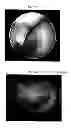 Fig. 11 - METHODS FOR PREPARATION OF NEO-CARTILAGE CONSTRUCTS