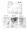 Fig. 15 - METHODS FOR PREPARATION OF NEO-CARTILAGE CONSTRUCTS