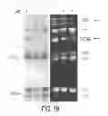 Fig. 31 - MATERIALS AND METHODS FOR CONTROLLING VASCULOGENESIS FROM ENDOTHELIAL COLONY FORMING CELLS