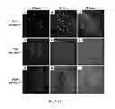 Fig. 16 - COLLAGEN BASED MATERIALS AND USES RELATED THERETO