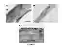 Fig. 19 - COLLAGEN BASED MATERIALS AND USES RELATED THERETO