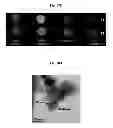 Fig. 23 - Dopamine nanocapsules and uses thereof