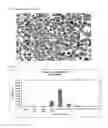 Fig. 03 - METHOD FOR THE PREPARATION OF A PHARMACEUTICAL COMPOSITION COMPRISING 5-AMINOSALICYLIC ACID FOR USE IN TREATMENT OF ULCERATIVE COLITIS AND CROHN'S DISEASE