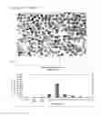 Fig. 04 - METHOD FOR THE PREPARATION OF A PHARMACEUTICAL COMPOSITION COMPRISING 5-AMINOSALICYLIC ACID FOR USE IN TREATMENT OF ULCERATIVE COLITIS AND CROHN'S DISEASE