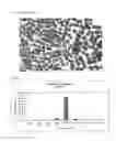 Fig. 06 - METHOD FOR THE PREPARATION OF A PHARMACEUTICAL COMPOSITION COMPRISING 5-AMINOSALICYLIC ACID FOR USE IN TREATMENT OF ULCERATIVE COLITIS AND CROHN'S DISEASE