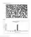 Fig. 07 - METHOD FOR THE PREPARATION OF A PHARMACEUTICAL COMPOSITION COMPRISING 5-AMINOSALICYLIC ACID FOR USE IN TREATMENT OF ULCERATIVE COLITIS AND CROHN'S DISEASE