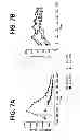 Fig. 11 - Compositions and Methods for Treating Metabolic Disorders