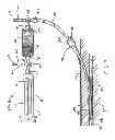Fig. 04 - Methods of closing wounds
