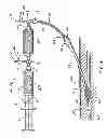 Fig. 05 - Methods of closing wounds