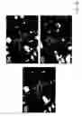 Fig. 37 - Kinase inhibitor compounds