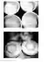 Fig. 11 - SOY/MILK CHEESE-TYPE AND YOGHURT-TYPE PRODUCTS AND METHOD OF MAKING