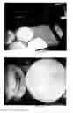 Fig. 12 - SOY/MILK CHEESE-TYPE AND YOGHURT-TYPE PRODUCTS AND METHOD OF MAKING