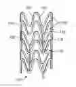 Fig. 01 - Stent with preferential coating