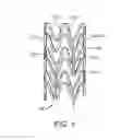 Fig. 02 - Stent with preferential coating