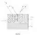 Fig. 22 - Method of forming white appearing anodized films by laser beam treatment