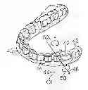 Fig. 01 - System and method for detecting deviations during the course of an orthodontic treatment to gradually reposition teeth