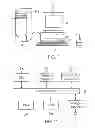Fig. 02 - System and method for detecting deviations during the course of an orthodontic treatment to gradually reposition teeth